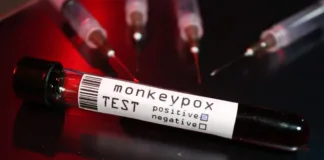 Europa registra 100 casos diários de mpox e OMS pede ação global 2824 europa registra 100 casos diarios de mpox e oms pede acao global
