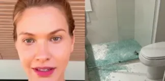 6958 andressa suita faz alerta apos sofrer acidente domestico nao parava de sangrar