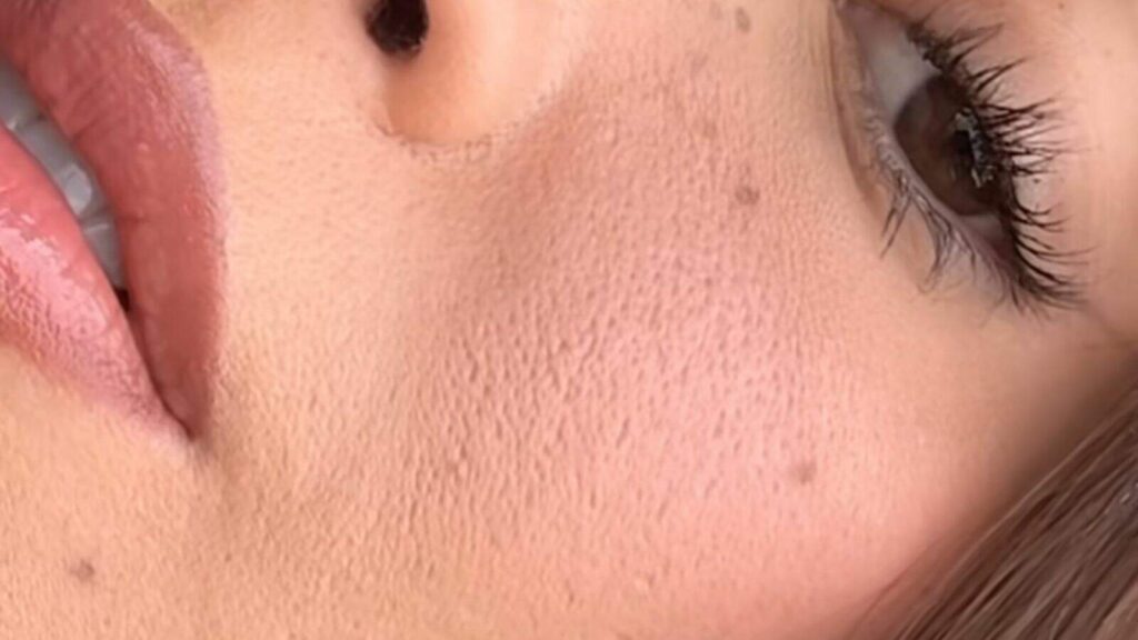 bianca-andrade-posta-video-mostrando-a-textura-da-pele