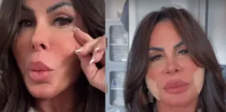 16546 gretchen aparece sem curativos e rebate haters que a chamaram de fofao