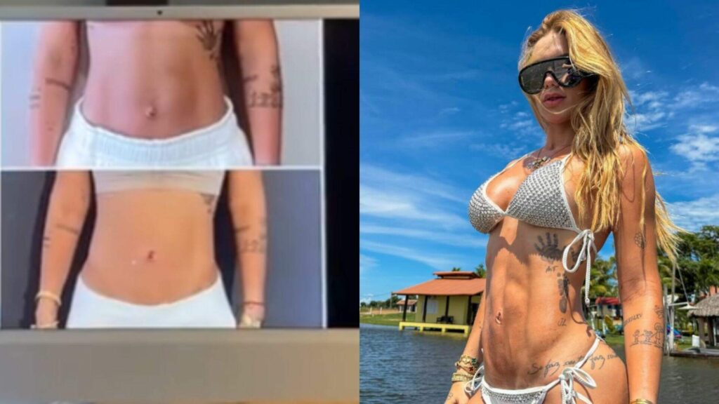 virginia-exibe-antes-e-depois-de-seu-umbigo-apos-cirurgia