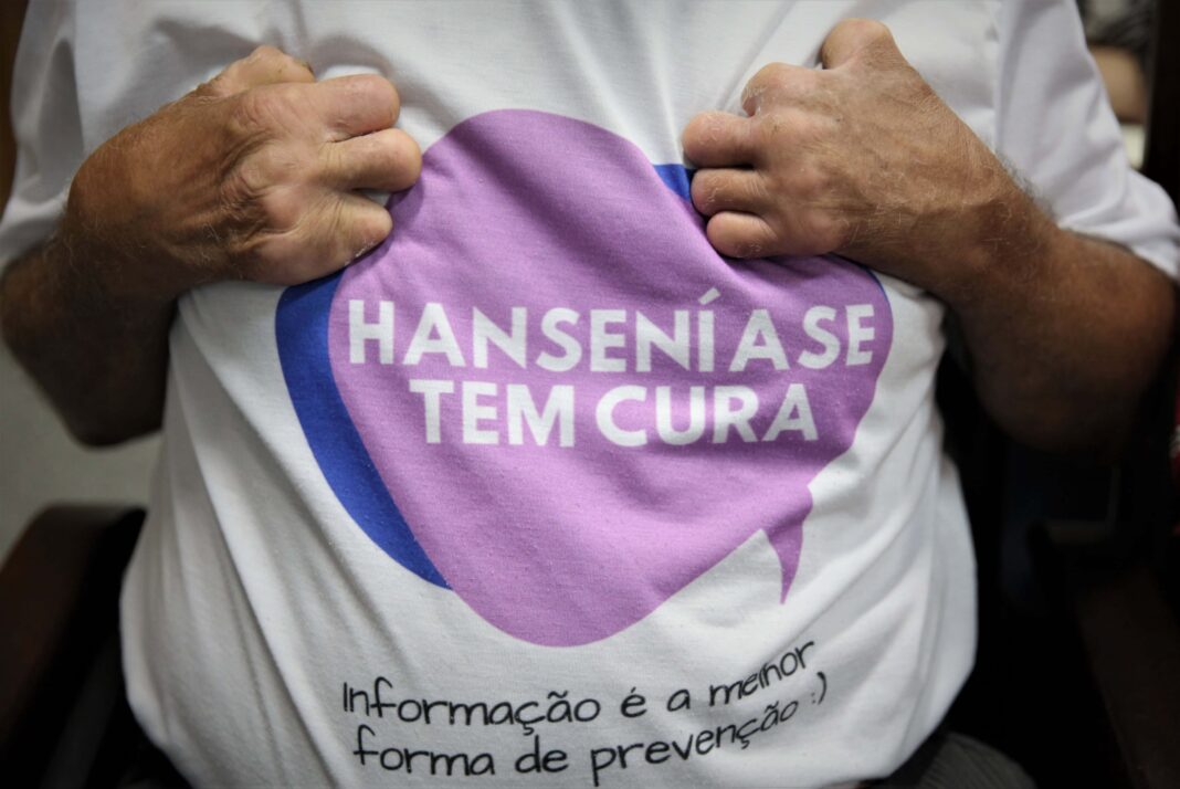 no-janeiro-roxo,-saude-do-acre-ressalta-importancia-de-diagnostico-precoce-e-tratamento-contra-a-hanseniase