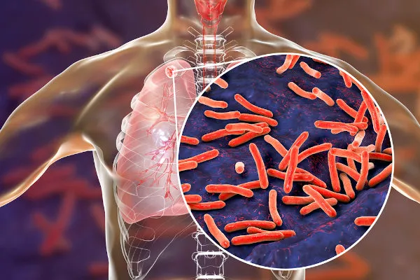 surto-de-tuberculose,-desnutricao-e-suicidio-ameaca-indigenas-no-acre