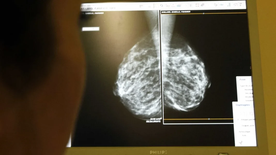 cancer-foi-a-segunda-principal-causa-de-morte-no-brasil-em-2024