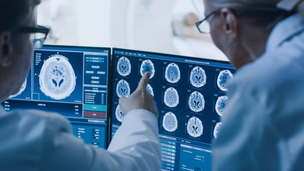 diabetes-pode-ter-efeito-no-cerebro-semelhante-ao-do-alzheimer