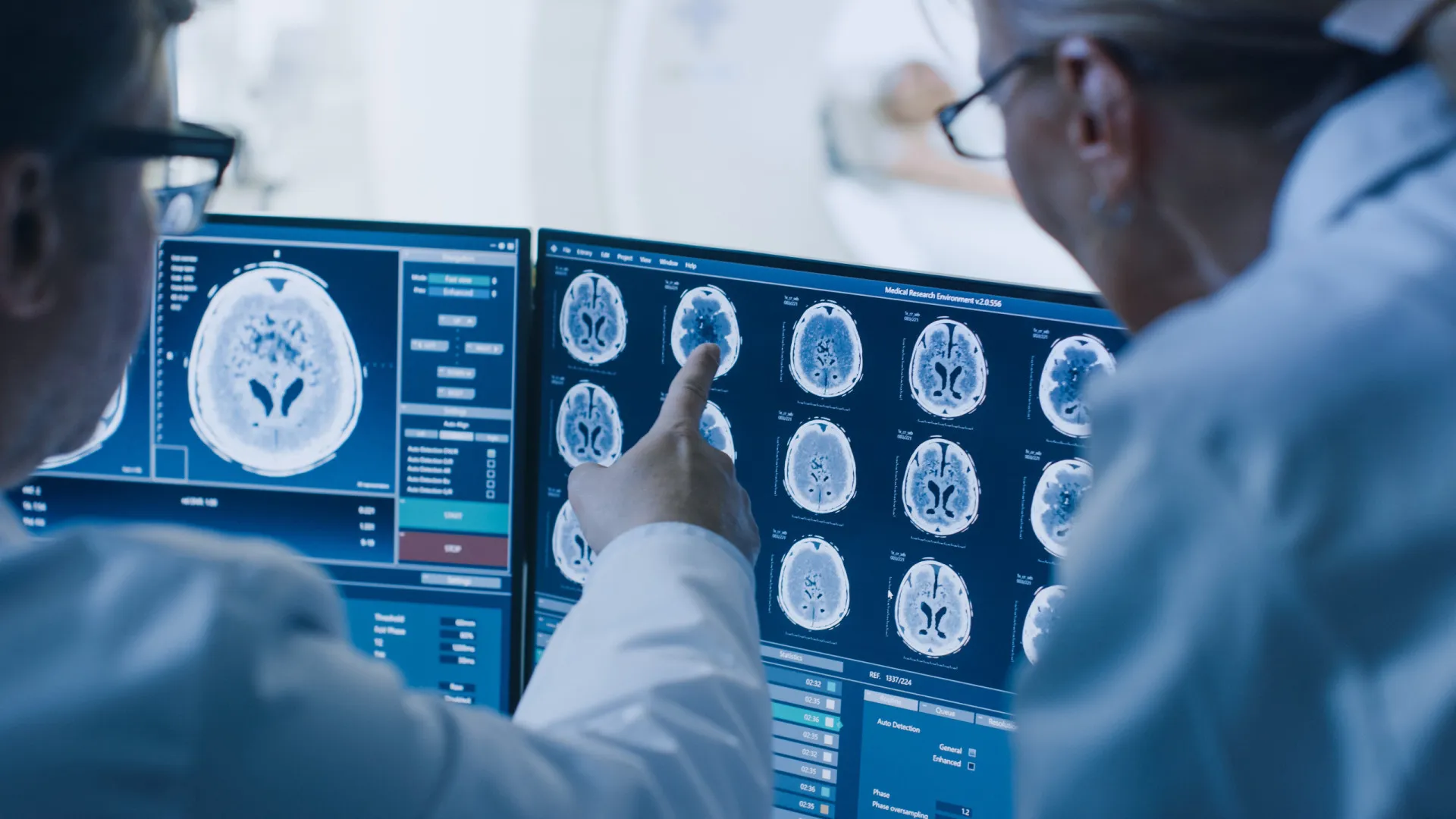 diabetes-pode-ter-efeito-no-cerebro-semelhante-ao-do-alzheimer