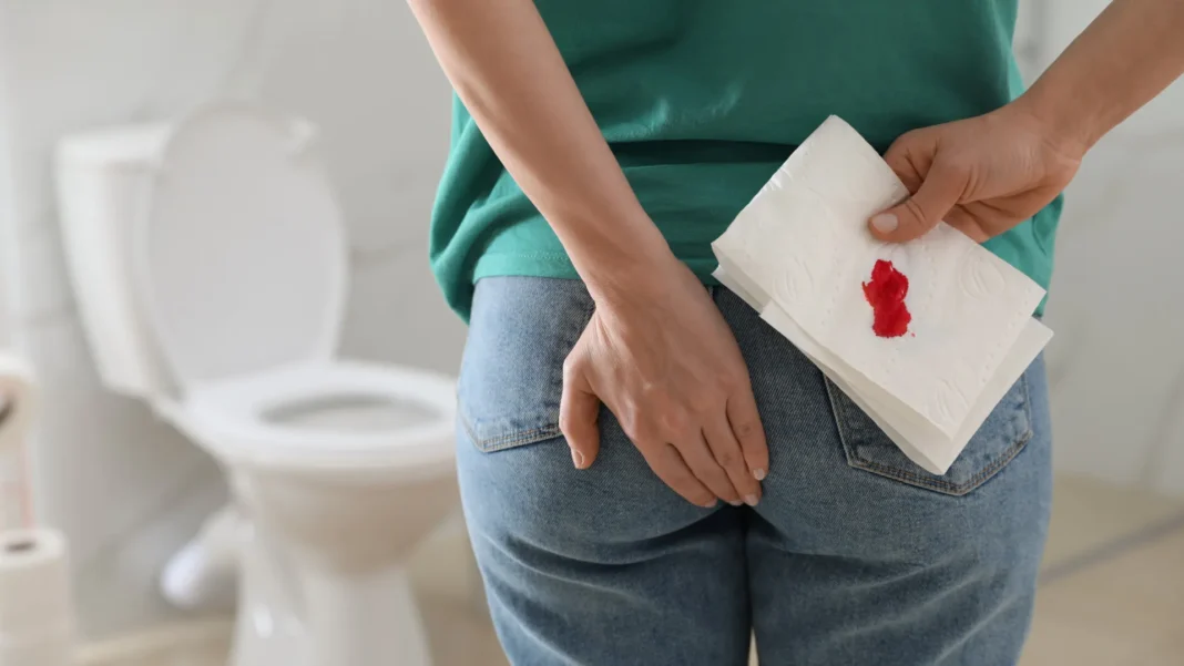 “procure-um-especialista”;-cinco-sinais-do-cancer-de-intestino
