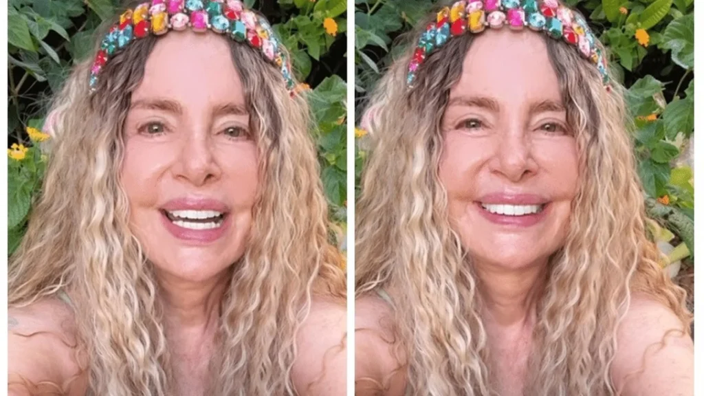 isis-de-oliveira-rebate-criticas-por-procedimentos-esteticos