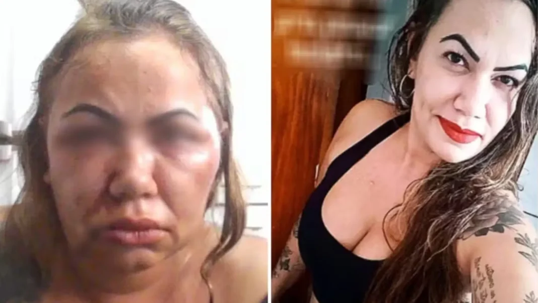 mulher-perde-parte-da-audicao-apos-ser-espancada-por-2-horas-por-seu-ex