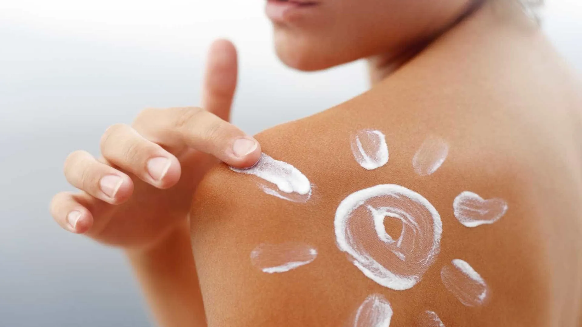 verao:-esqueceu-o-protetor?-o-que-fazer-em-casos-de-queimaduras-solares
