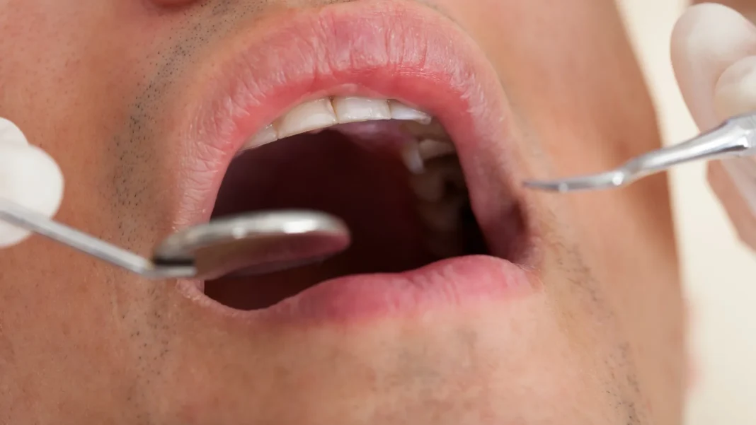 32%-dos-brasileiros-nao-foram-ao-dentista-no-ultimo-ano