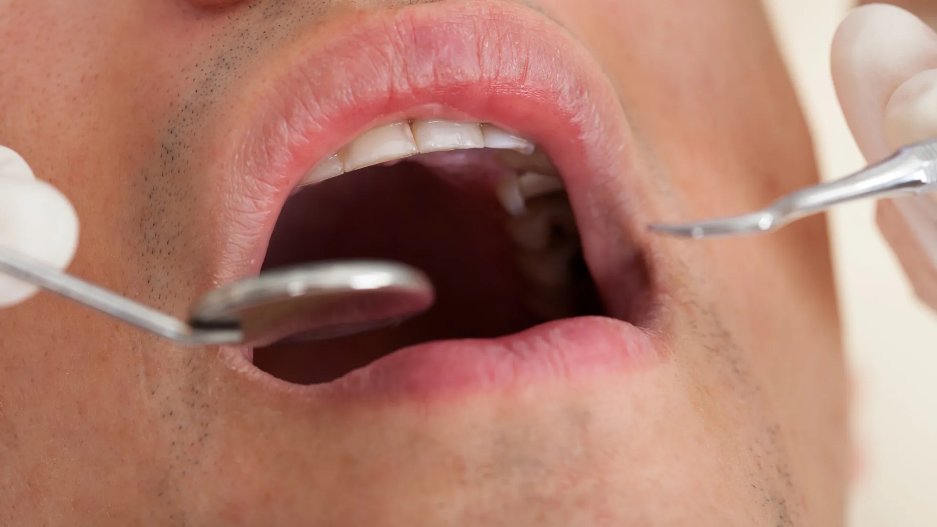 32%-dos-brasileiros-nao-foram-ao-dentista-no-ultimo-ano