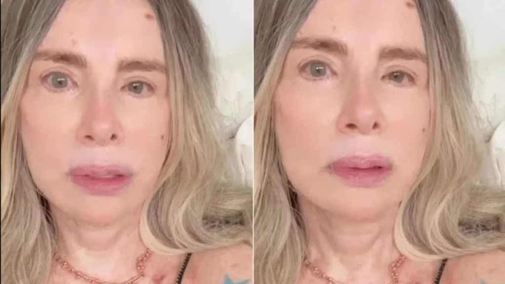 isis-de-oliveira-comemora-cura-do-cancer-de-pele:-‘estou-livre’