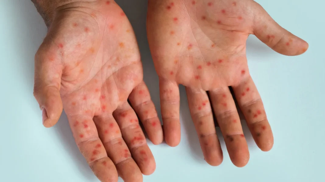 o-novo-virus-que-surgiu-no-alasca-ja-fez-sua-primeira-vitima-fatal