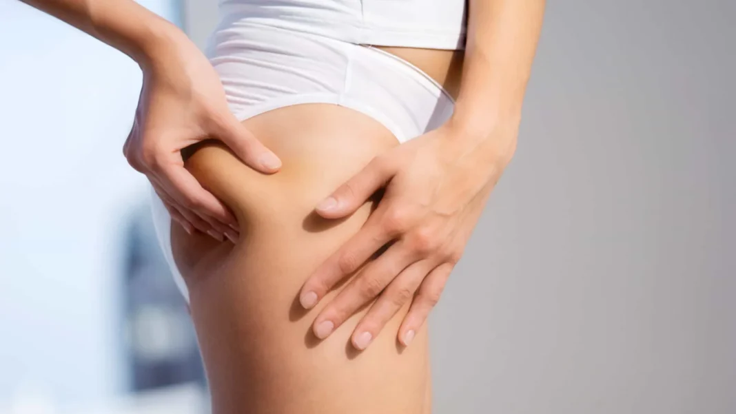 sete-alimentos-que-ajudam-a-amenizar-a-celulite