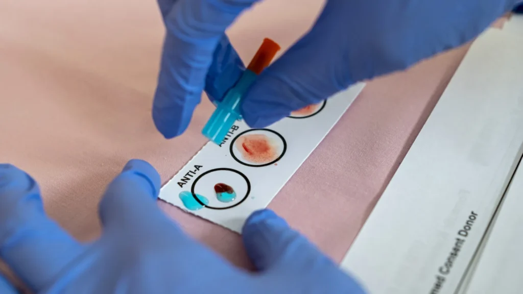 Tipo sanguíneo: As doenças mais comuns que você pode ter – Cidade AC News tipo-sanguineo:-as-doencas-mais-comuns-que-voce-pode-ter