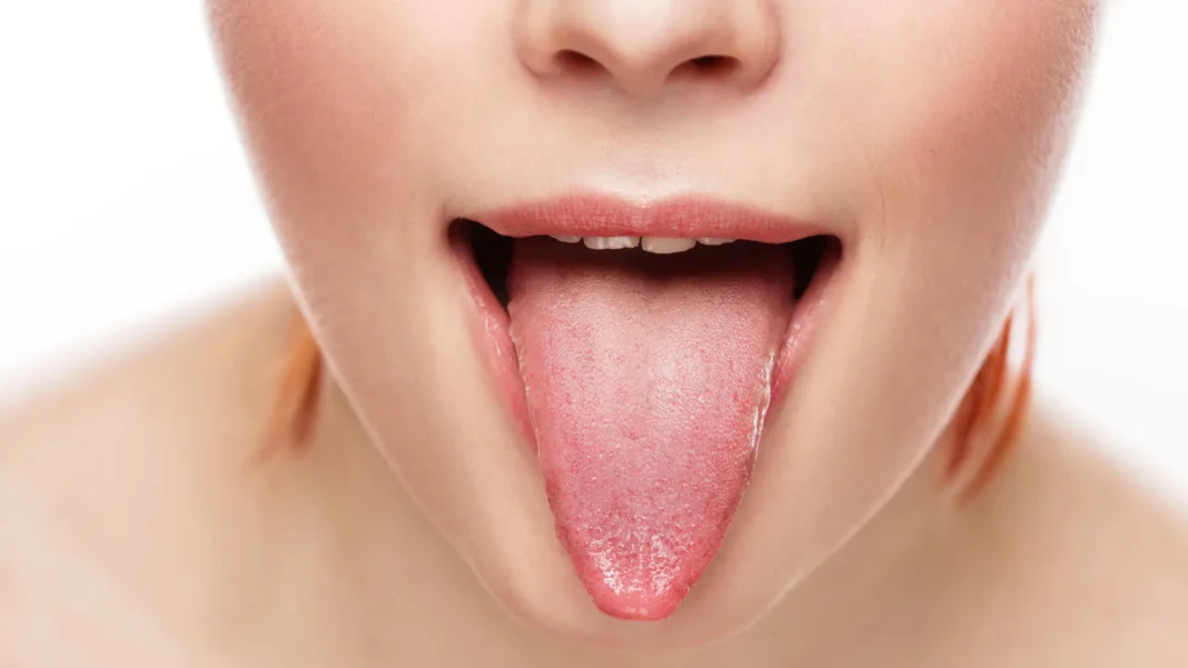 de-que-cor-e-sua-lingua?-saiba-como-isso-pode-afetar-sua-saude