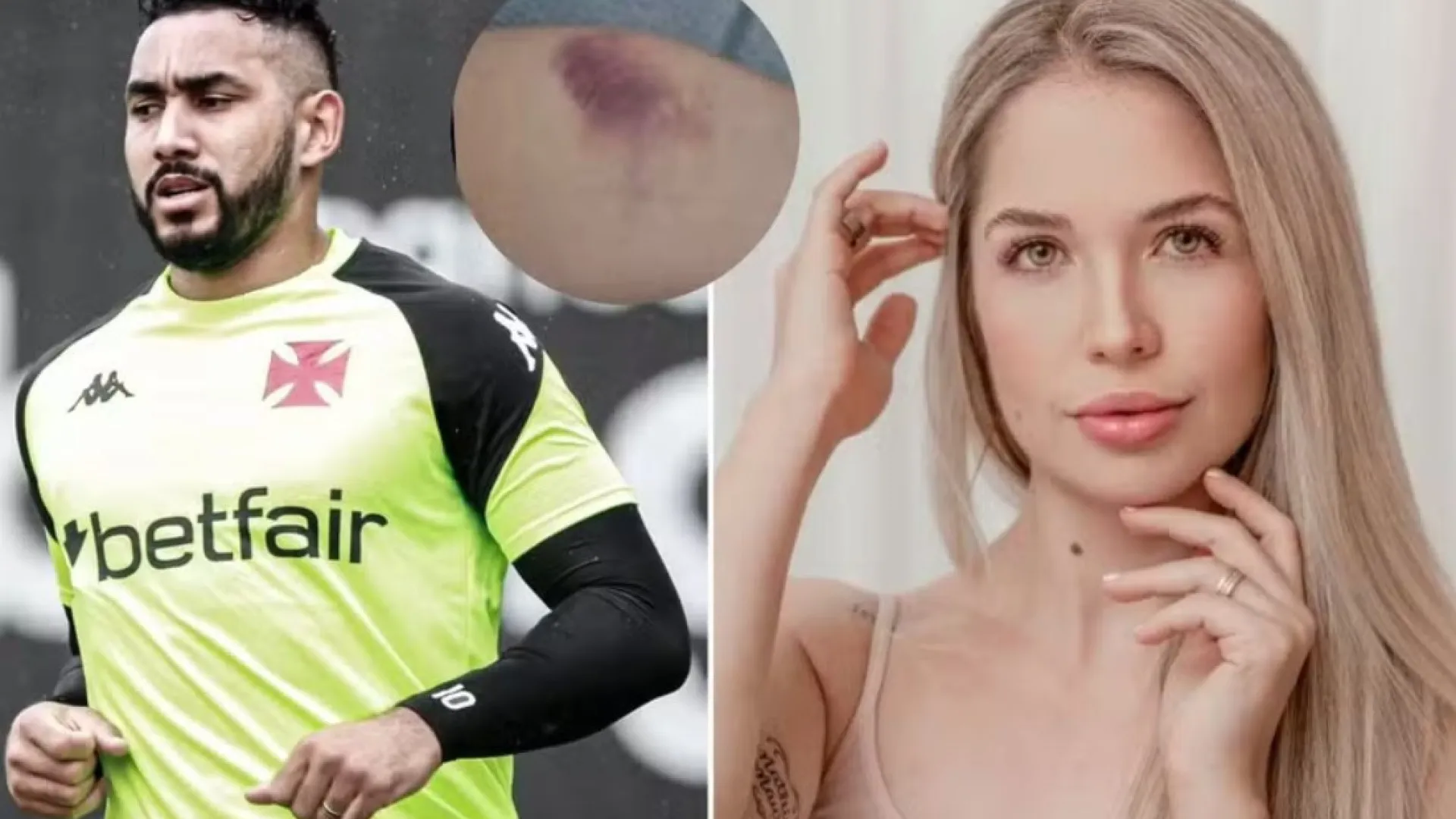 payet-nega-agressao,-mas-diz-que-beber-urina-era-comum-entre-o-casal