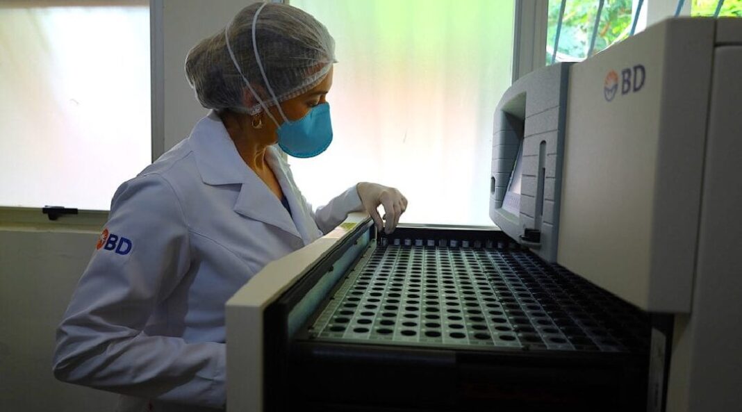 novo-equipamento-acelera-diagnostico-de-tuberculose-no-acre