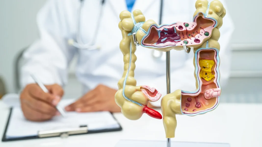 sete-alimentos-que-podem-prejudicar-a-saude-do-seu-intestino;-entenda