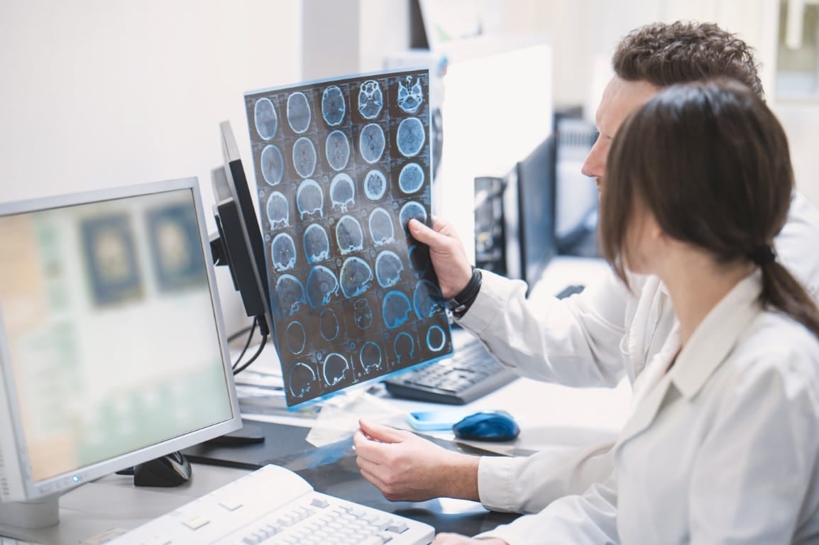 Avc -Exame - Cerebro - Acidente Vascular Cerebral
