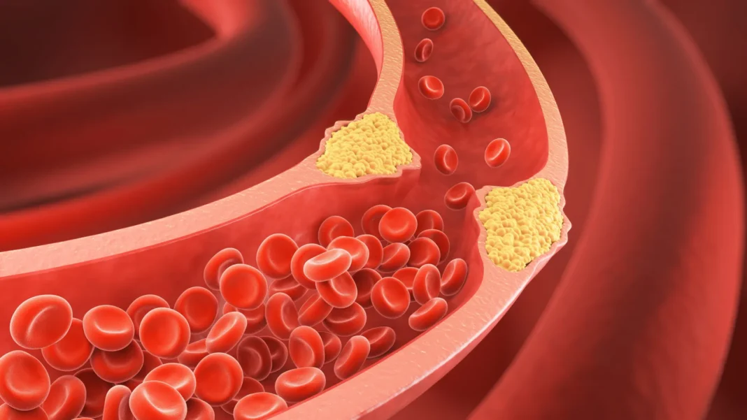 6-alimentos-que-ajudam-a-manter-as-arterias-desobstruidas