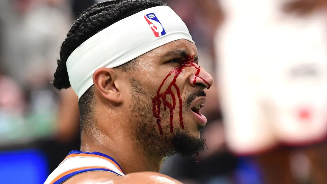 jogador-dos-new-york-knicks-fica-sangrando-apos-cotovelada