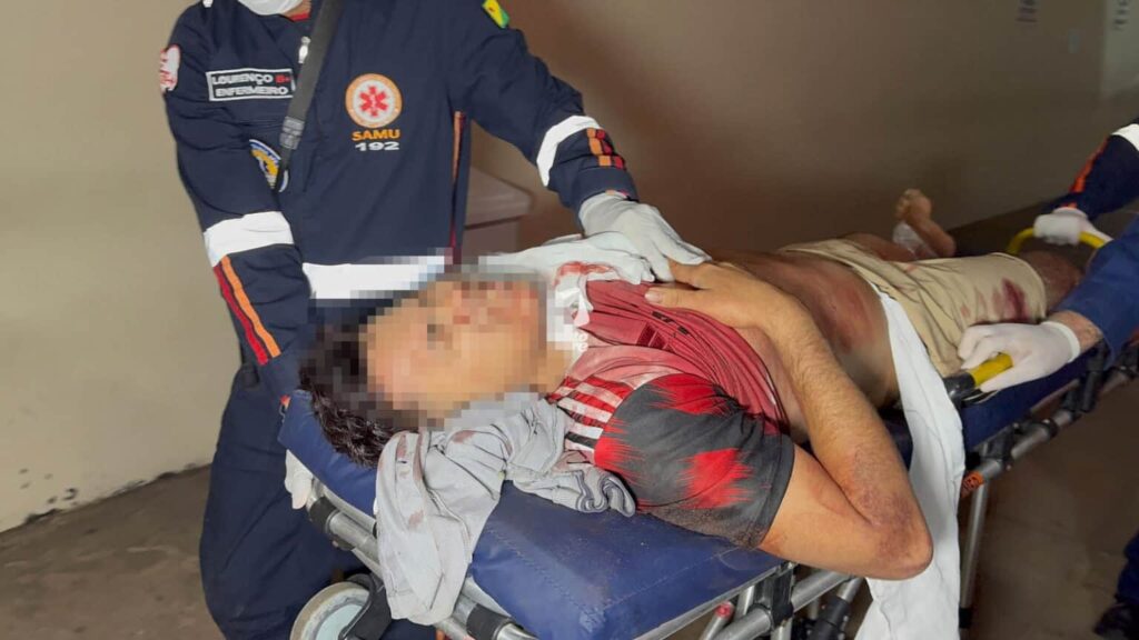 morre-no-ps-jovem-baleado-durante-festa-de-confraternizacao-em-rio-branco