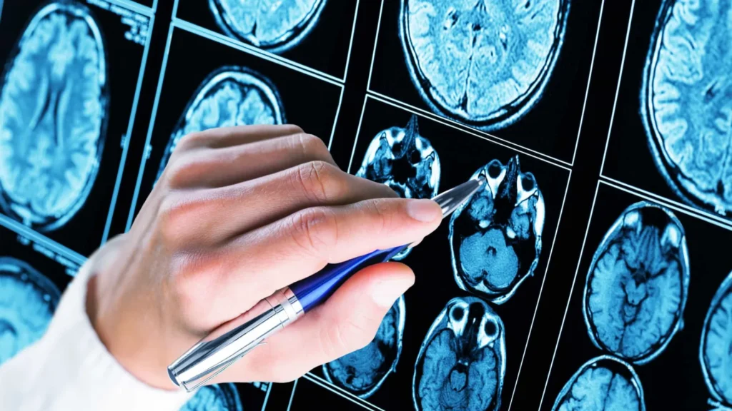 teste-ocular-detecta-autismo-em-bebes-com-80%-de-precisao