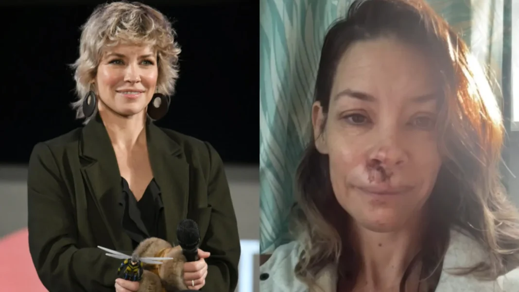 evangeline-lilly,-estrela-de-‘lost’,-sofre-acidente-na-praia evangeline-lilly,-estrela-de-‘lost’,-sofre-acidente-na-praia