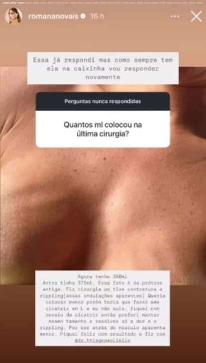 Romana Novais responde sobre silicone