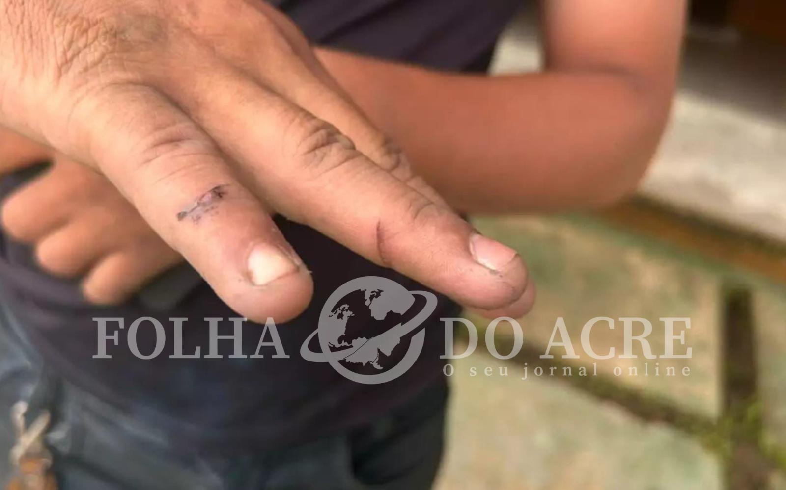 Cerol faz duas vítimas em Cruzeiro do Sul e reacende alerta sobre riscos em brincadeiras com pipas | Cidade AC News – Notícias do Acre