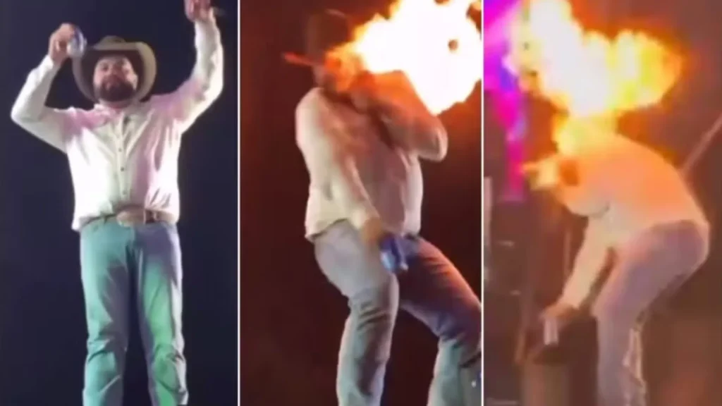 sertanejo-mostra-como-ficou-seu-rosto-apos-ser-queimado-em-show;-video