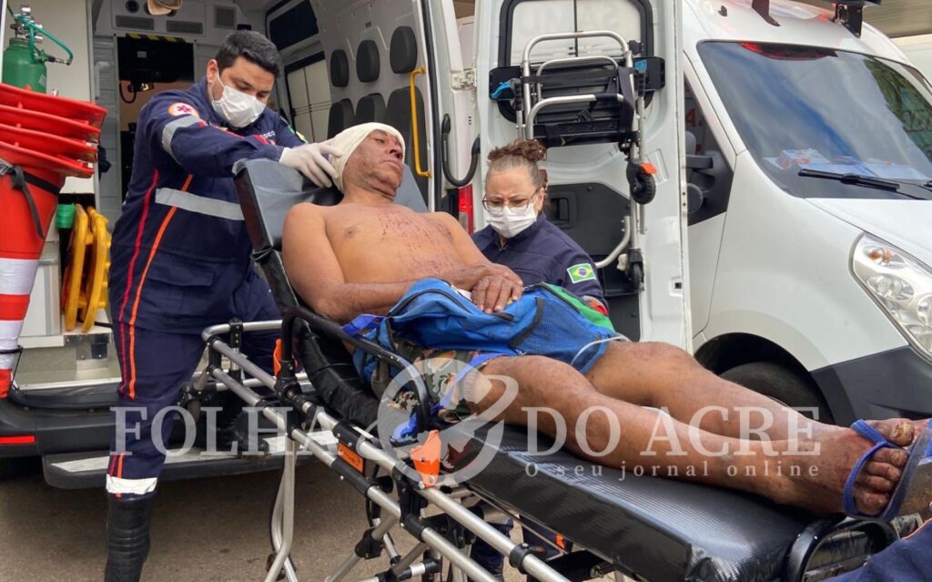 Homem se recusa a sair de casa e é agredido com golpe de perna-manca na cabeça pelo dono do imóvel – Cidade AC News homem-se-recusa-a-sair-de-casa-e-e-agredido-com-golpe-de-perna-manca-na-cabeca-pelo-dono-do-imovel