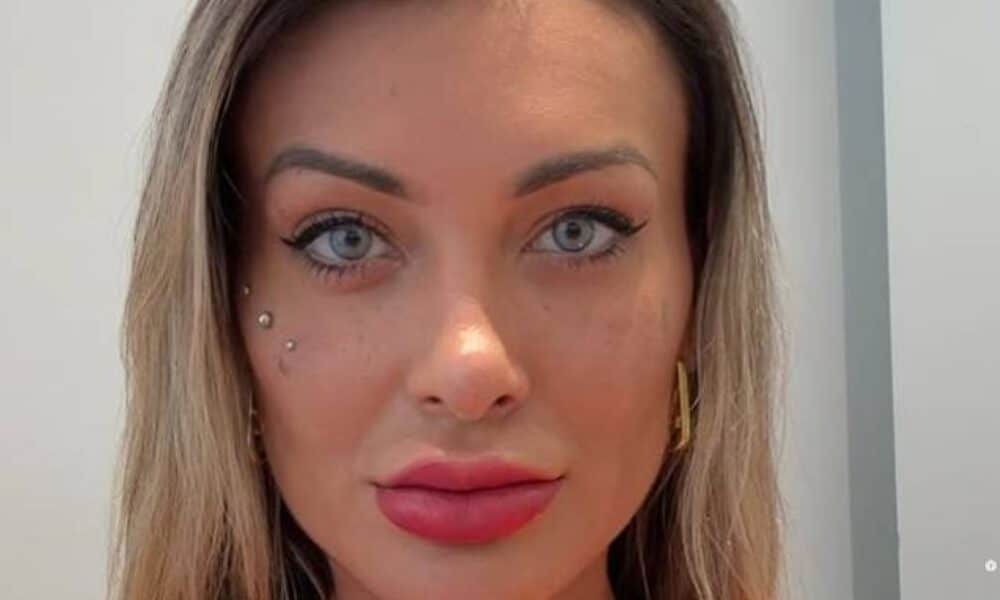 andressa-urach-lamenta-cirurgia-de-olhos-na-franca-com-risco-de-cegueira
