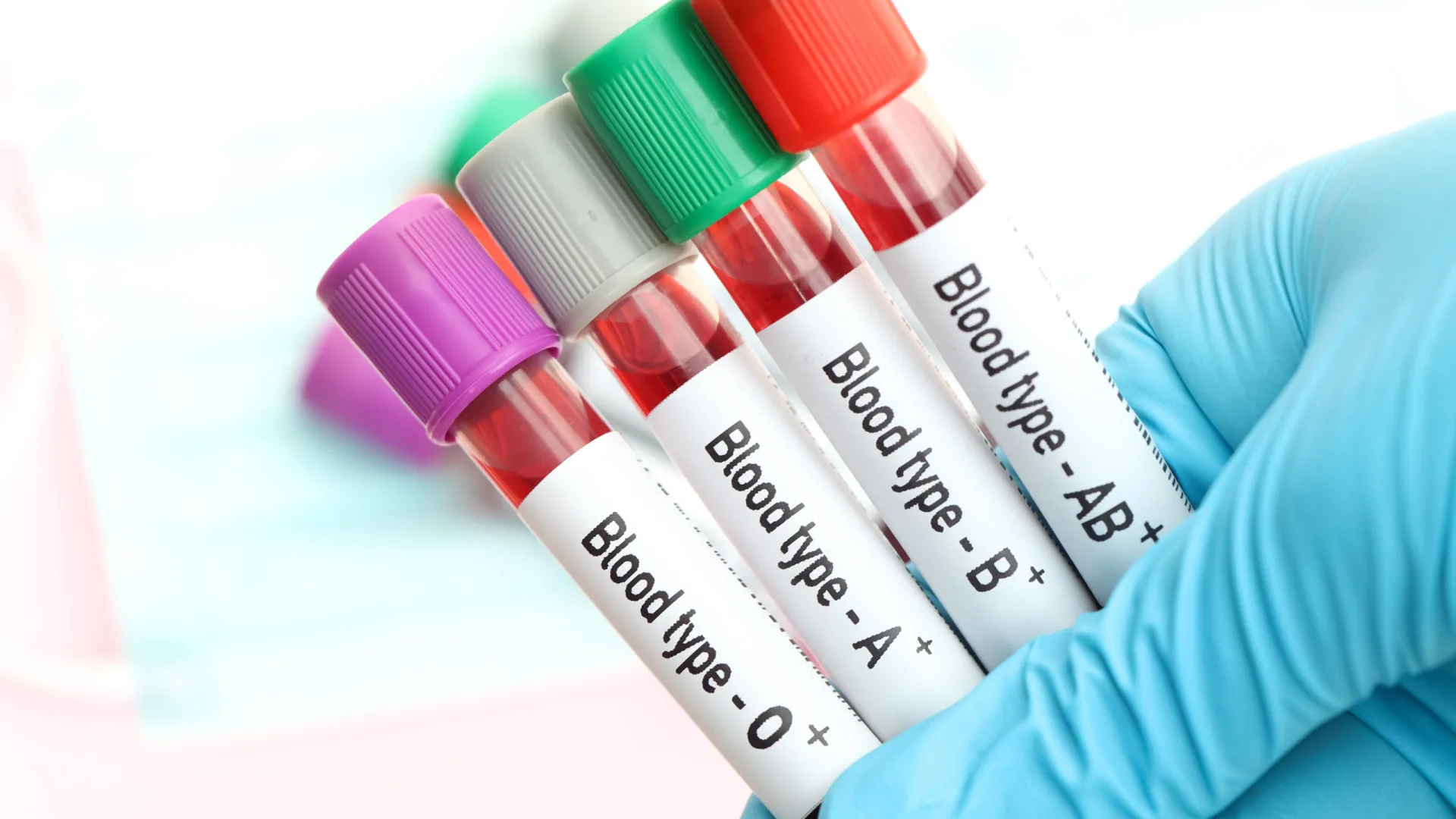 tipo-sanguineo-pode-influenciar-risco-de-avc-precoce,-aponta-estudo