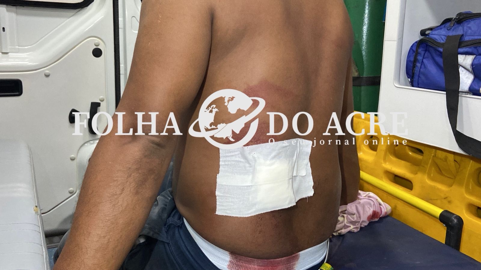 vendedor-de-galinhas-e-esfaqueado-apos-dizer-que-nao-tinha-mais-aves-para-vender-na-baixada-da-sobral,-em-rio-branco