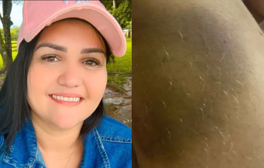 morte-de-enfermeira-em-upa-no-acre-expoe-suposto-historico-de-violencia-domestica