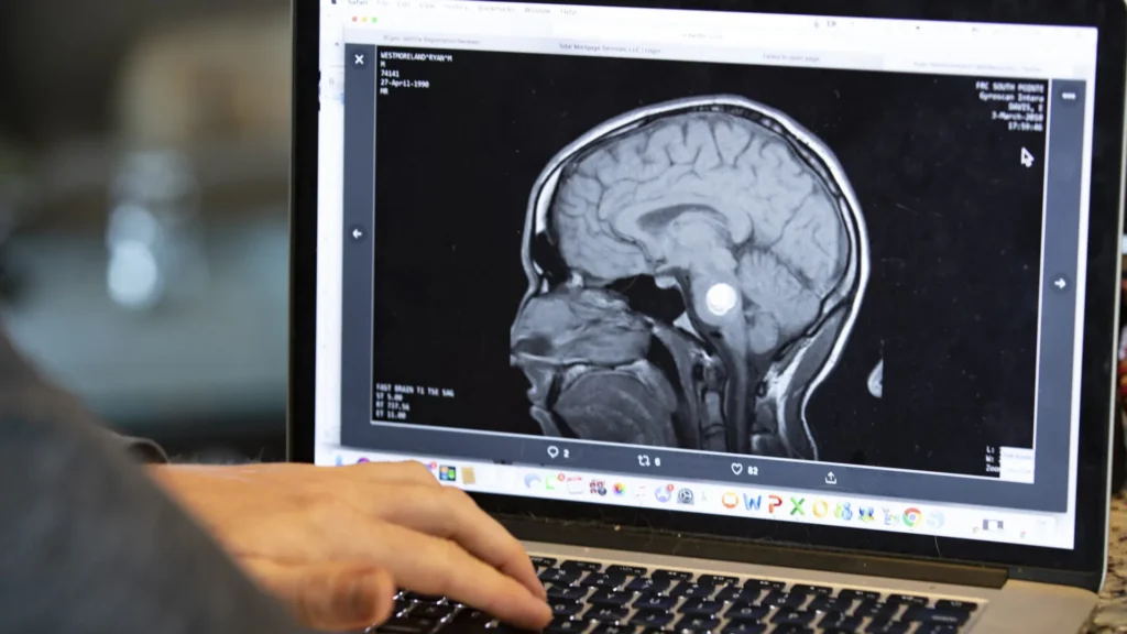 voce-usa-mais-o-lado-direito-ou-esquerdo-do-cerebro?