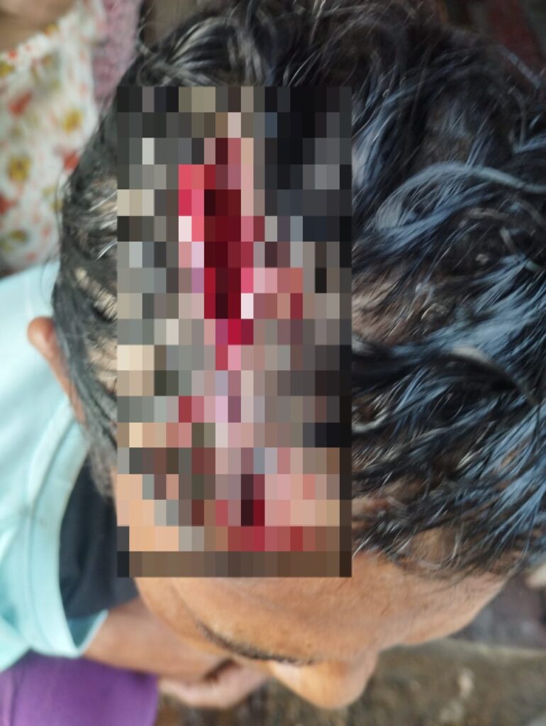 Polícia Civil prende dupla suspeita de assassinato e tentativa de triplo homicídio em Feijó | Cidade AC News – Notícias do Acre