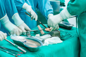 Fundhacre realiza mais um transplante ósseo e reforça importância da doação de órgãos e tecidos | Cidade AC News – Notícias do Acre