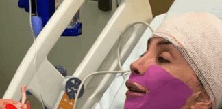 maya-massafera-retira-ossos-do-maxilar-em-nova-cirurgia