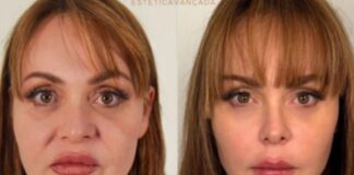 gaby-spanic,-de-usurpadora,-surge-irreconhecivel-apos-harmonizacao-facial