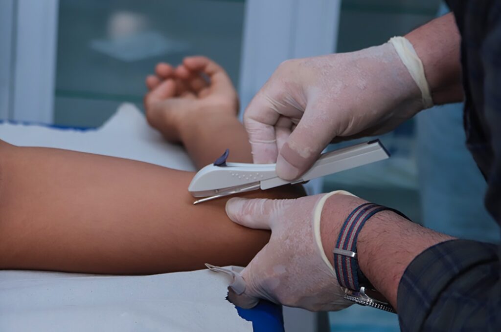 rio-branco-reforca-prevencao-a-gravidez-na-adolescencia-com-capacitacao-para-metodos-contraceptivos-de-longa-duracao