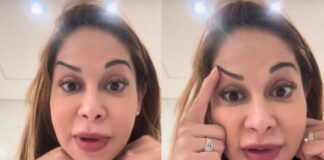 Maíra Cardi exibe rosto deformado após botox dar errado: maira-cardi-exibe-rosto-deformado-apos-botox-dar-errado: