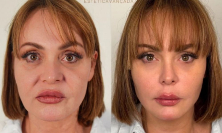 Gaby Spanic, de Usurpadora, surge irreconhecível após harmonização facial | Cidade AC News – Notícias do Acre