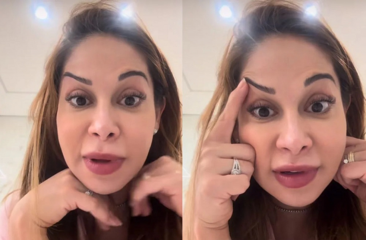 Maíra Cardi exibe rosto deformado após botox dar errado: | Cidade AC News – Notícias do Acre