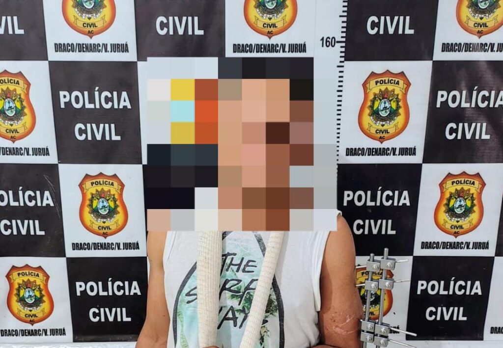 Polícia Civil do Acre prende homem suspeito de furtar celular de mãe que acompanhava filha internada no Hospital do Juruá | Cidade AC News – Notícias do Acre