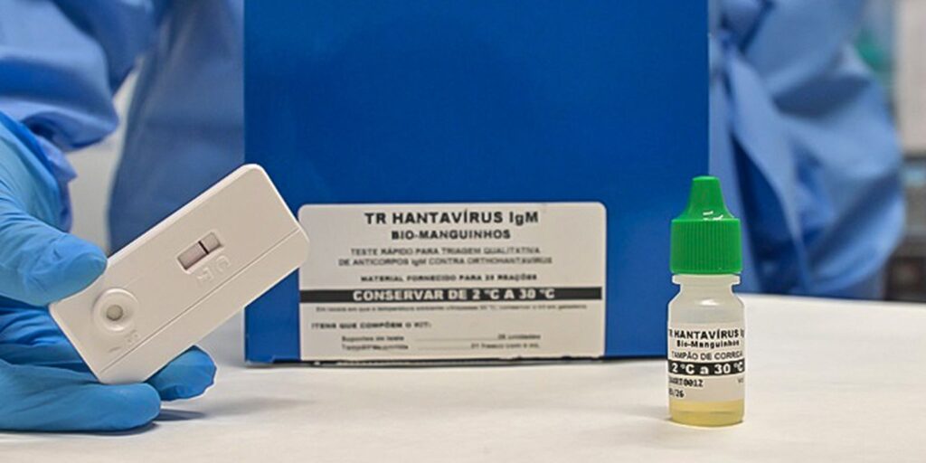 Novo teste faz diagnóstico de hantavirose em 20 minutos – Cidade AC News novo-teste-faz-diagnostico-de-hantavirose-em-20-minutos