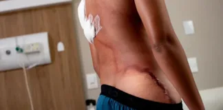 jovem-ferido-por-raio-durante-ato-politico-deixa-hospital